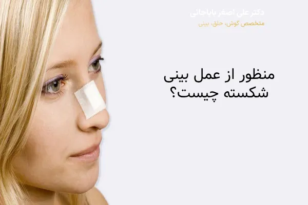 عمل بینی شکسته چیست؟