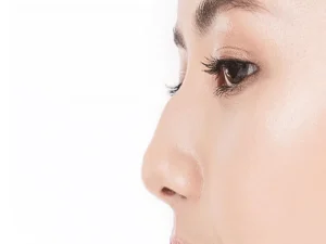جراحی قوز بینی