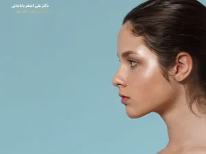 پیوند غضروف در جراحی بینی