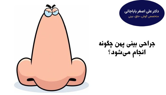 نحوه جراحی بینی پهن