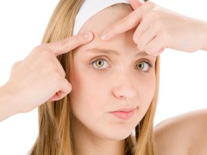 جوش صورت بعد از عمل بینی