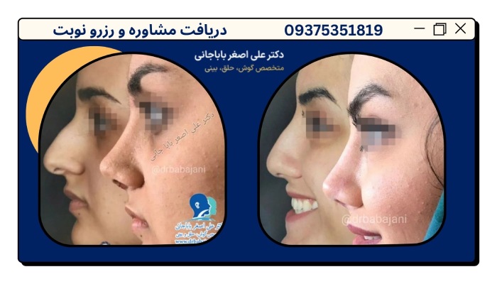 نمونه کار بهترین جراح بینی در جردن