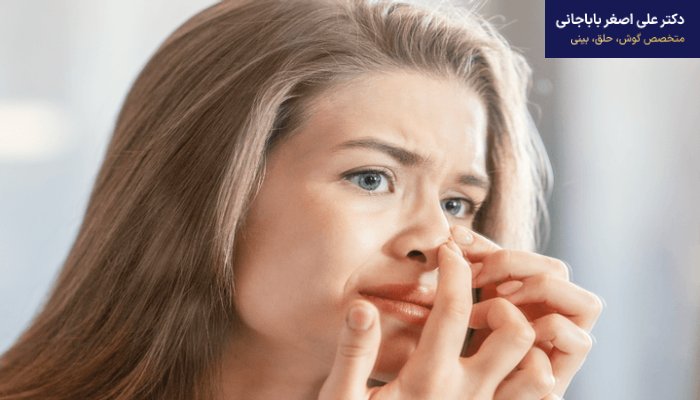 رفع کجی بینی بعد از عمل