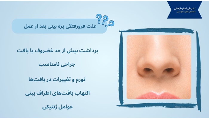 علت فرورفتگی پره بینی بعد از عمل