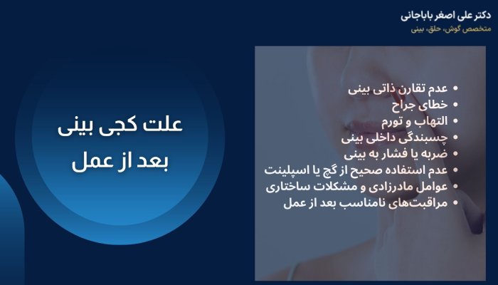 علت کجی بینی بعد از عمل
