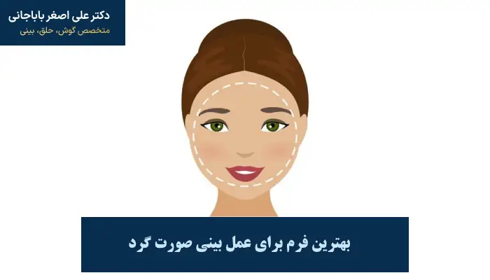 بهترین فرم برای عمل بینی صورت گرد