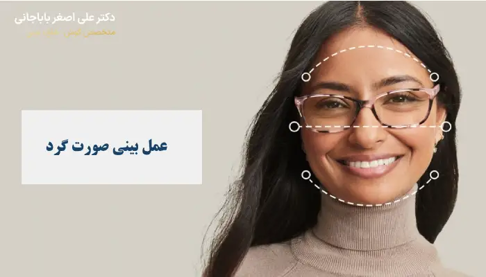عمل بینی صورت گرد چیست؟