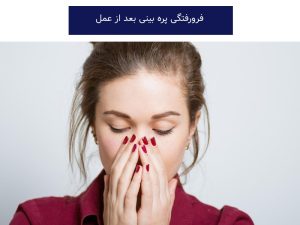 فرورفتگی پره بینی بعد از عمل