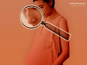 بارداری بعد از عمل بینی