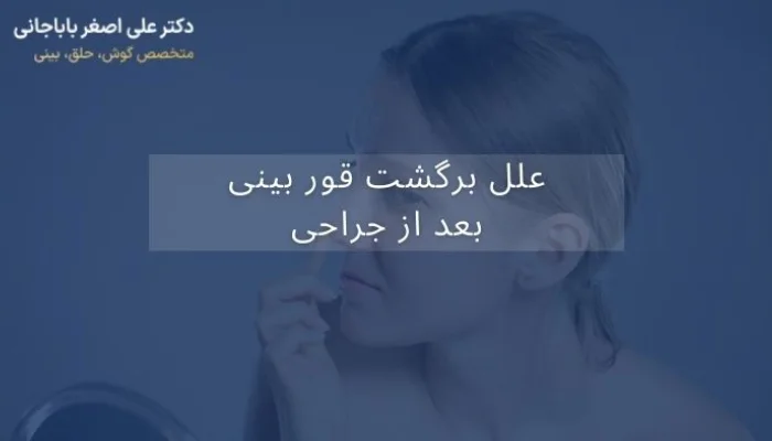 علل برگشت قوز بینی بعد از عمل