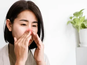 تنگی مجرای بینی