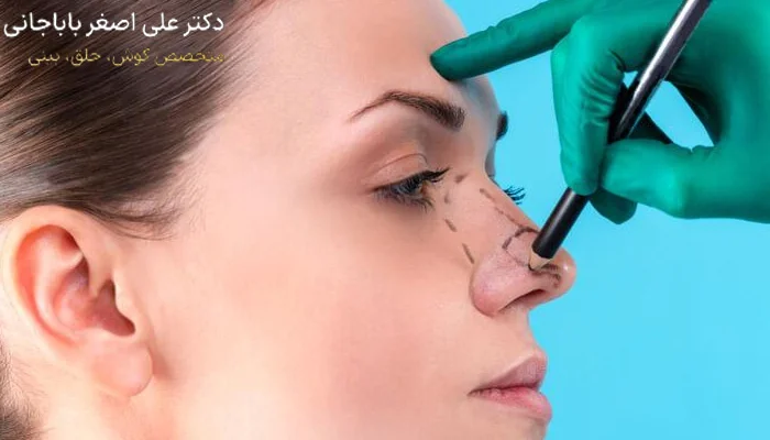 نحوه عمل جراحی بینی نیمه فانتزی