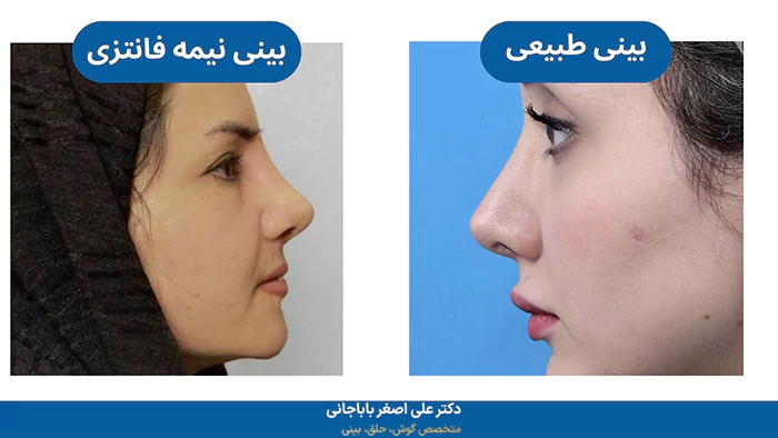 عکس بینی نیمه فانتزی و طبیعی