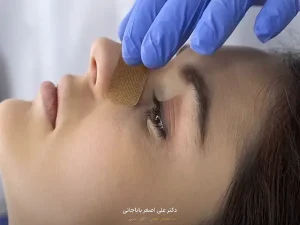برگشت بینی گوشتی بعد از عمل