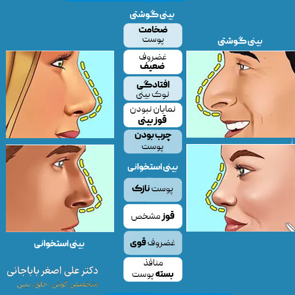تفاوت بینی گوشتی و استخوانی چیست