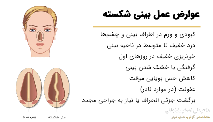 لیستی از عوارض عمل بینی شکسته همرا با تصویر بینی شکسته