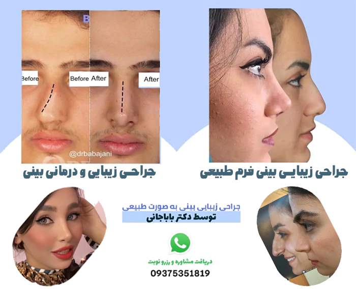 نمونه کار عمل بنی توسط دکتر باباجانی