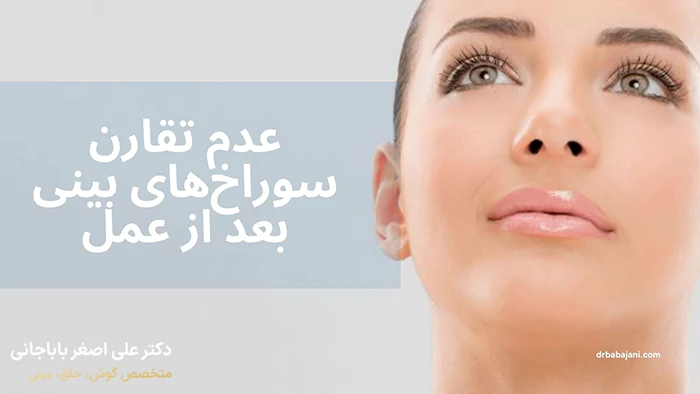 عدم تقارن بینی بعد از عمل
