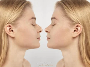 ماندگاری نتایج عمل بینی