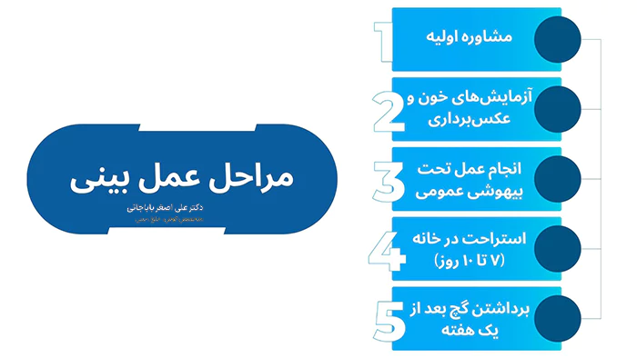 مراحل عمل بینی