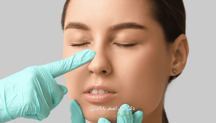 آیا بینی من عمل میخاد؟